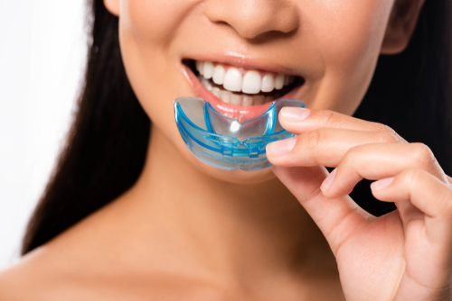 mouth guard